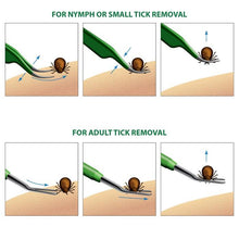 Load image into Gallery viewer, 2-Pack: BritenWay Stainless Steel Tick Remover Set