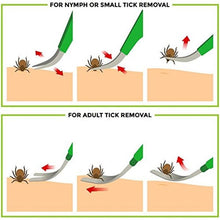 Load image into Gallery viewer, 2-Pack: BritenWay Stainless Steel Tick Remover Set