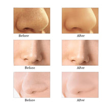 Load image into Gallery viewer, Vivitar Ultra Suction Microdermabrasion/Facial Pore Cleanser