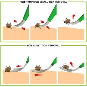 2-Pack: BritenWay Stainless Steel Tick Remover Set