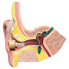 Load image into Gallery viewer, Personal Sound Amplifier Hearing Aid with Protective Case
